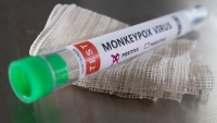 Bệnh đậu mùa khỉ: Mỹ nâng mức độ cảnh báo, Anh phát hiện số đột biến cao