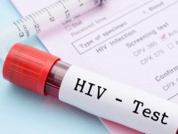 Phương pháp xét nghiệm HIV mới cho kết quả nhanh nhất