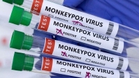 Bệnh đậu mùa khỉ: Mỹ gia tăng ca mắc, Anh cảnh báo lây nhiễm