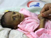 Cảnh báo nguy cơ hơn 1 triệu trẻ em mắc bệnh tả ở Yemen