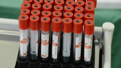 Chuyên gia Nga xóa tan quan niệm sai lầm về kháng thể đối với virus SARS-CoV-2